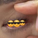 구로-구로-구로-2963 | (스킨케어) 인천 주안동 용주르샵 비립종 제거 내돈내산 후기