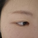 비브에스테틱 | 마곡역피부관리 서울잔흔제거 붉은눈썹지우기 비브에스테틱 눈썹잔흔관리 후기