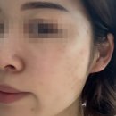 인투호텔 | 부산 해운대 에스테틱 부산 해운대 스파 인투더래빗홀 스파 &amp; 마사지 해운대