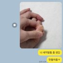 엘앤제이커피 | 오송 엘앤제이왁싱 레푸스 | 문제성발톱 스케일링 교정 후기