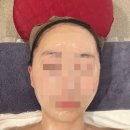 [수원 금곡동] 민에스테틱 : 호매실 에너지테라피 피부관리, 노블젝션 두피관리 후기