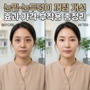 독플래닛 | 리아이필러 완벽 가이드, 눈밑·눈두덩이 꺼짐 개선 효과·가격·부작용·후기 총정리
