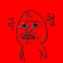 남수원약국 | 치핵 치질 3기 수술 후기 수원 항문외과 치핵수술 치질수술