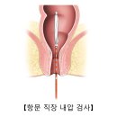 변실금[Fecal incontinence]소화기질환 이미지