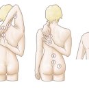 바디리페어 이미지