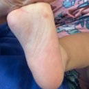 (주)한일진단 | 18개월 아기 수족구 병원에서 옮은 후기 수족구 경과기록 수족구 관리방법