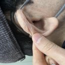 시그니아독일보청기 동작센터 | 동작구보청기 시그니아 독일보청기 동작센터 상담 후기와 추천