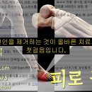 피로 골절 원인과 치료 - 사암오행침, 사암침법, 오행침, 정통사암침 이미지