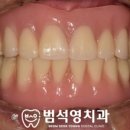 범석영치과 이미지