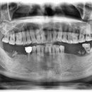 더튼튼플란트치과의원 이미지