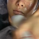 (주)코루파마 | 북구 피부과 잘하는 곳 /쥬베룩 후기 - 부산 피부과 추천