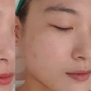 예쁜여우피부관리 이미지