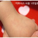 &lt;비타브리드 씨 12 아토시스 플러스&gt; 바르는 비타민C파우더