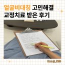 미소생한의원 | 안양 안면비대칭교정 치료 받은 후기