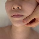 서면윤곽관리 코아페이즈 코아웨딩 솔직후기