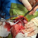 JA 임상병리 동물병원 | 중증 괴사성 담낭염과 담낭 파열로 진행된 응급 복막염: 고령견에서의 수술적 치료와 조직병리 평가