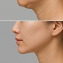 CU익산감초점 | 주름 개선제 완전 가이드