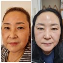 인셀덤 사용 하신 분들의 후기
