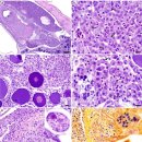 Fusasporis stethaprioni감염 tetra의 새로운 질병 테트라 전신성 미포자충병(TDM) 이미지