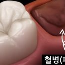 정성플러스치과 이미지