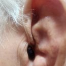 고운소리청각센터 | 청각장애 등급 신청 전 꼭 확인 | 기준,절차,혜택