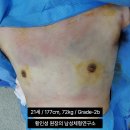 프라우드비뇨기과의원 | 여유증 수술 비용 가격 통증 병원 치료 핵심은