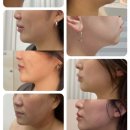 기로 | 창원에스테틱 추천 창원여드름·창원피부관리·창원속건조 관리아기로가에스테틱 솔직후기