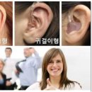 휴보청기 중랑 난청센터 이미지