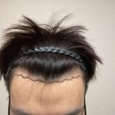 바람부는날에도 성형외과의원 이미지