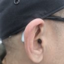 유니트론 보청기 | 전주벨톤보청기, 👂 40대 남성 유니트론 비반테 보청기 착용 후기