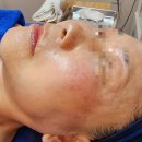 원천중학교 삼거리 ~ 아주플라자 | 화사로아뷰티 슈퍼잭션블랙 만족스러웠던 후기 안성피부관리