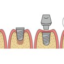보일치과의원 이미지