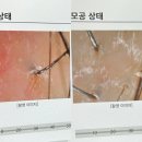 리메디칼 | 천안미용실 추천｜찰스리헤어테크 쌍용동점 윤서 케어리스트 두피케어 후기