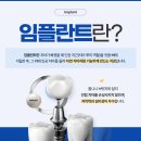 양평루트치과의원 네이버블로그