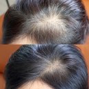 한국산소 | 고잉그레이 새치염색 셀프염색약, 셀럽 산소태닝 후기