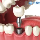 진플란트치과의원 이미지