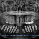 덴탈아트치과기공소 이미지