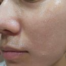 맑은아침 | 민감피부 세안제 추천, 자극없는 안심 미산성 세안제-오월의아침 맑은 세안제 사용 후기