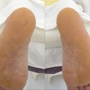 거북이유흥주점 | 유흥주점 사장님의 고충! 갈라진 뒷꿈치와 무좀 발톱 때문에 걷기도 힘들어!! - 레푸스제주점 -