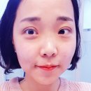 한울에프앤에스 홈플러스 영통점 | 영통 피부과,수원 리프팅레이저후기/퍼스트미의원/LDM+더블로+쿨리프팅
