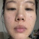 피부상담 - 북구 송해로 82-9 | 웨딩 피부관리 상담 후기 | 더록시 강남점 상담받은 솔직후기