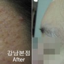 강남리유한의원 네이버블로그