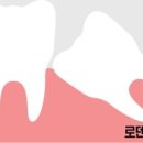 로덴치과의원(경성대,부경대점) 이미지