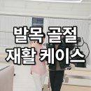 종촌동 필라테스 발목에 철심 박고 오신 회원님 재활후기
