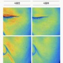 리터니셀 줄기세포 마스크팩, 청담 입소문 홈케어 직접 써본 후기