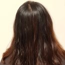 줌헤어필 | 닥터탑 헤어필 스위스 줄기세포 트리트먼트 리얼 후기~