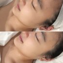 바디조짐 | 범계 에스테틱 커스텀미 3회차 관리 :: 셀카가 점점 잘 나오는 윤곽 리프트 후기