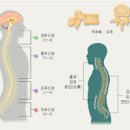 요추통증 급성요통을 부르는 원인 이미지