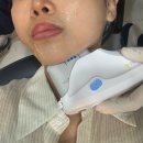 라임 | 노원 울쎄라 피프라임 400샷 내돈내산 후기 | 효과·붓기·통증 솔직리뷰