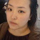 빅마트 파주운정점 앞 | 파주 운정피부과 온다리프팅으로 심부볼, 이중턱 뿌신 후기